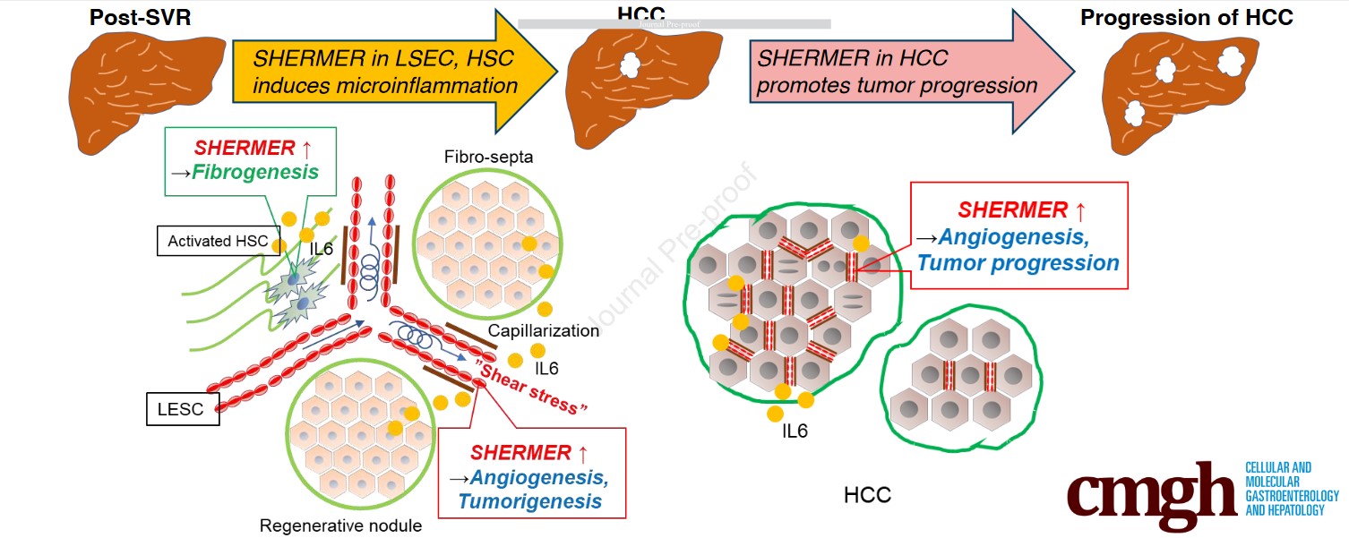 【原著論文】西川医師の論文がCellular and Molecular Gastroenterology and Hepatologyオンライン版に掲載されました