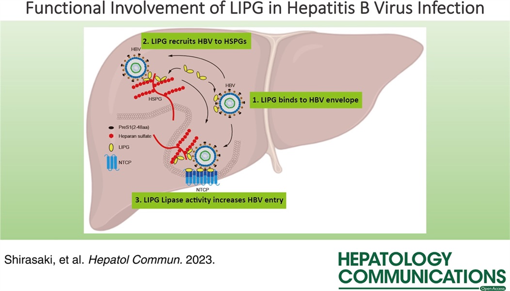 【原著論文】白崎助教による研究論文がHepatology Communicationsに掲載されました